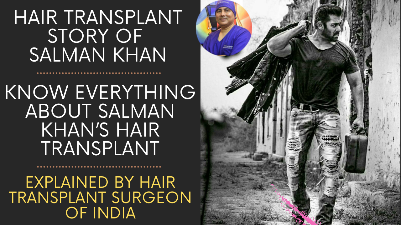 You are currently viewing HAIR TRANSPLANT STORY OF  SALMAN KHAN EXPLAINED BY HAIR TRANSPLANT SURGEON