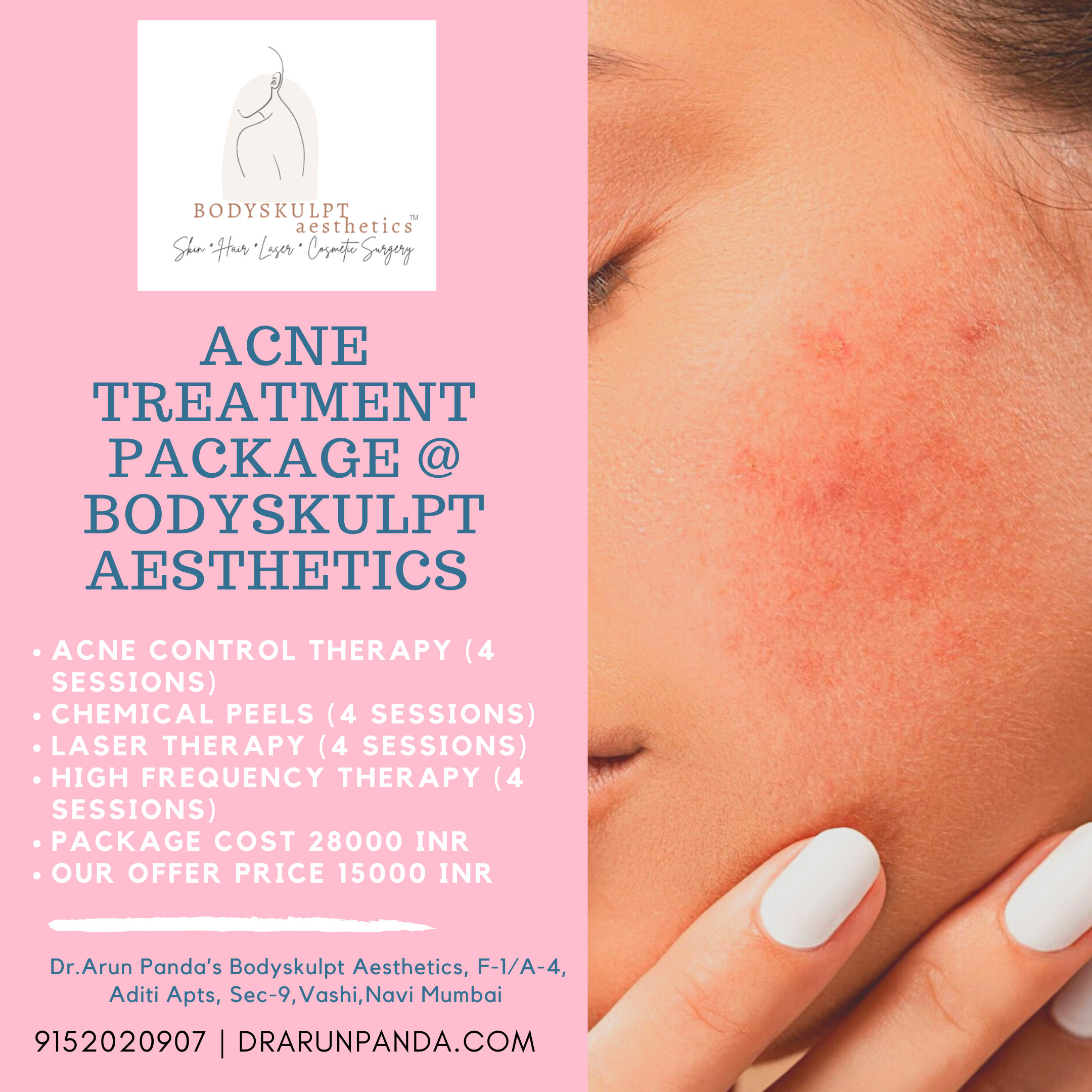 You are currently viewing Acne Treatment in Navi Mumbai by Dermatologist