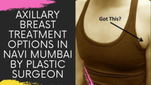 Read more about the article AXILLARY BREAST TREATMENT OPTIONS IN NAVI MUMBAI BY PLASTIC SURGEON