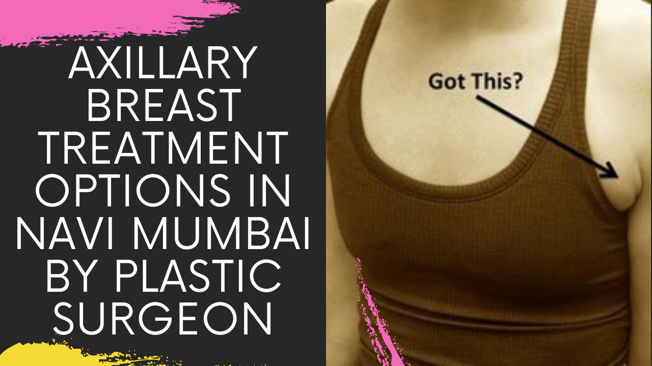 You are currently viewing AXILLARY BREAST TREATMENT OPTIONS IN NAVI MUMBAI BY PLASTIC SURGEON