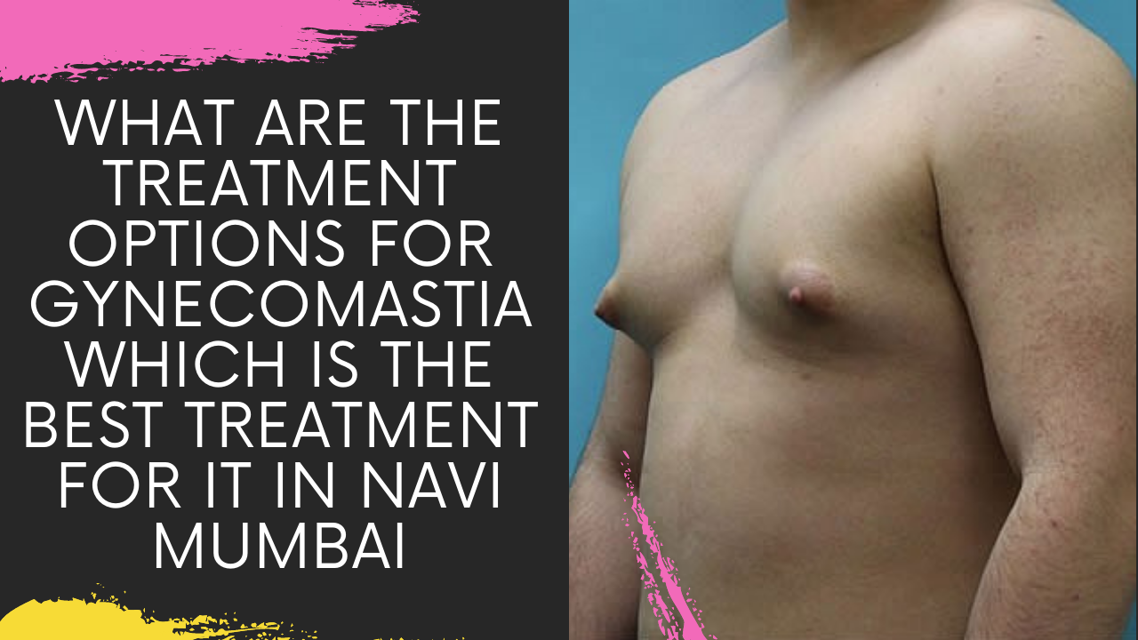 Read more about the article BEST TREATMENT FOR GYNECOMASTIA IN NAVI MUMBAI