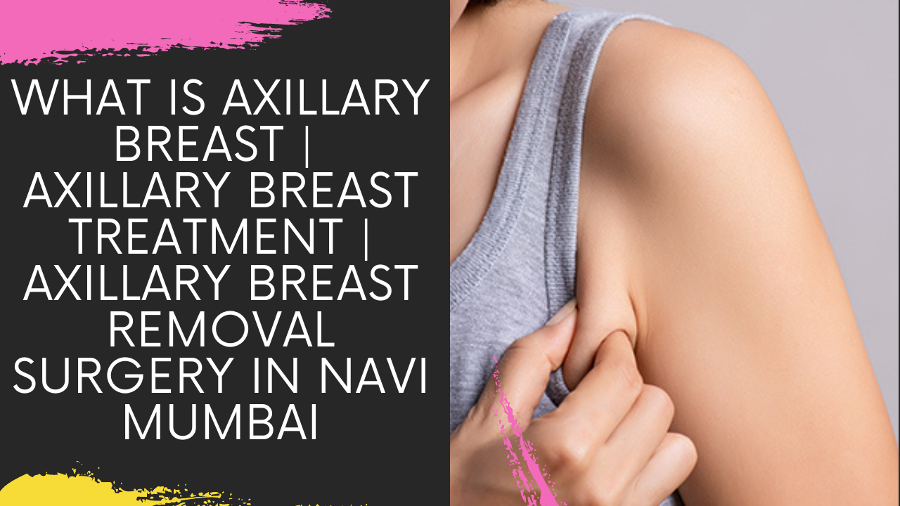 Read more about the article WHAT IS AXILLARY BREAST | AXILLARY BREAST TREATMENT | AXILLARY BREAST REMOVAL SURGERY IN NAVI MUMBAI