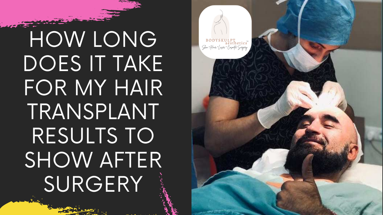 You are currently viewing HOW LONG DOES IT TAKE FOR HAIR TRANSPLANT RESULTS TO SHOW AFTER HAIR RESTORATION SURGERY IN MUMBAI