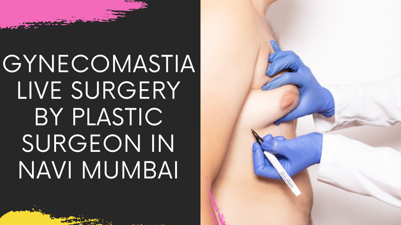 Read more about the article Gynecomastia Live Surgery by Plastic Surgeon in Navi Mumbai | Male Chest Reduction Mumbai