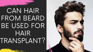 Read more about the article Can Hair from Beard be used for Hair Transplantation? What are the alternate donor areas?