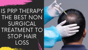 Read more about the article IS PRP THERAPY THE BEST NON SURGICAL TREATMENT TO STOP HAIR LOSS