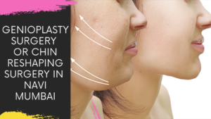 Read more about the article WHAT IS GENIOPLASTY OR CHIN RESHAPING SURGERY WATCH LIVE VIDEO OF THE PROCEDURE