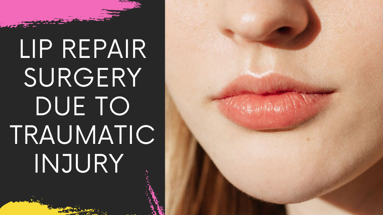 You are currently viewing Lip Repair Surgery due to traumatic Injury at Facial Aesthetic Clinic in Navi Mumbai