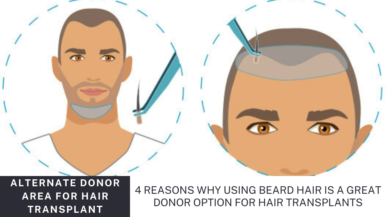 Read more about the article Why using beard hair is a great donor option for hair transplants