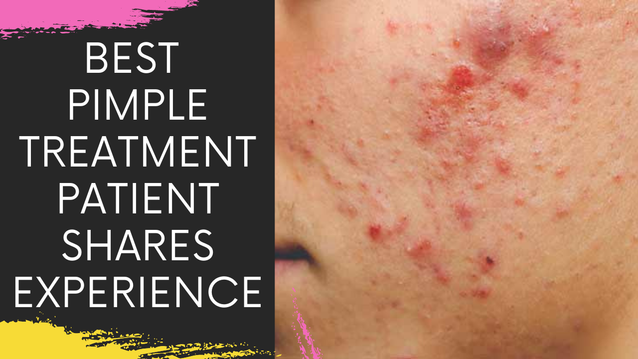 Read more about the article Acne and Pimple Treatment in Navi Mumbai
