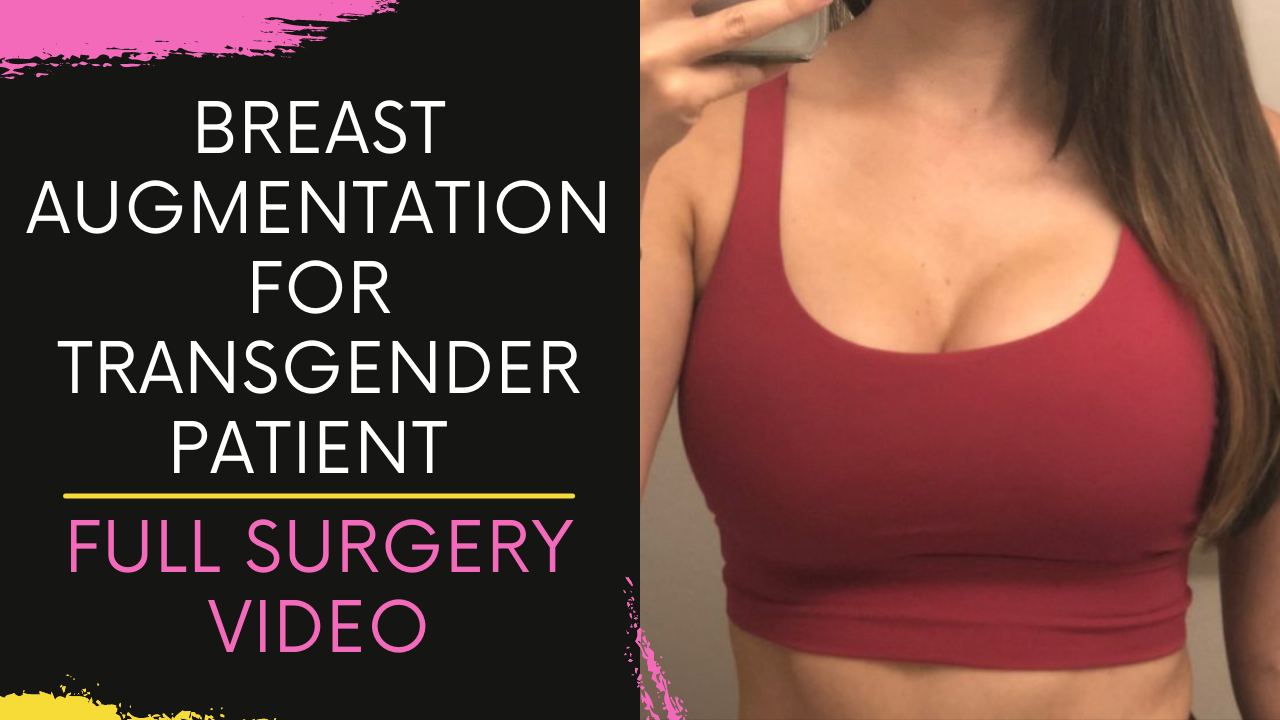 You are currently viewing Breast Augmentation for Transgender patient Performed at Bodyskulpt Aesthetics in Navi Mumbai, India
