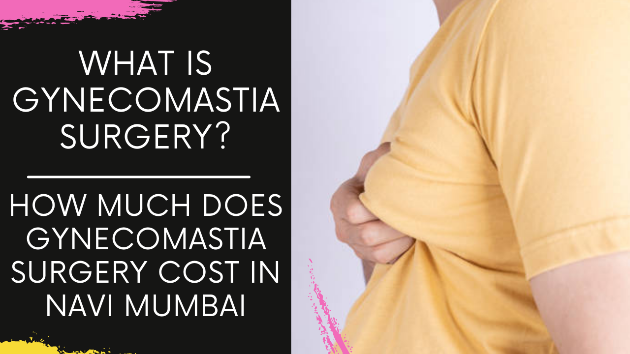 You are currently viewing What is Gynecomastia Surgery? How is it performed? What is the cost in Navi Mumbai?