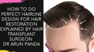 Read more about the article How to do perfect hairline design for hair restoration explained by Hair Transplant Surgeon Dr Arun