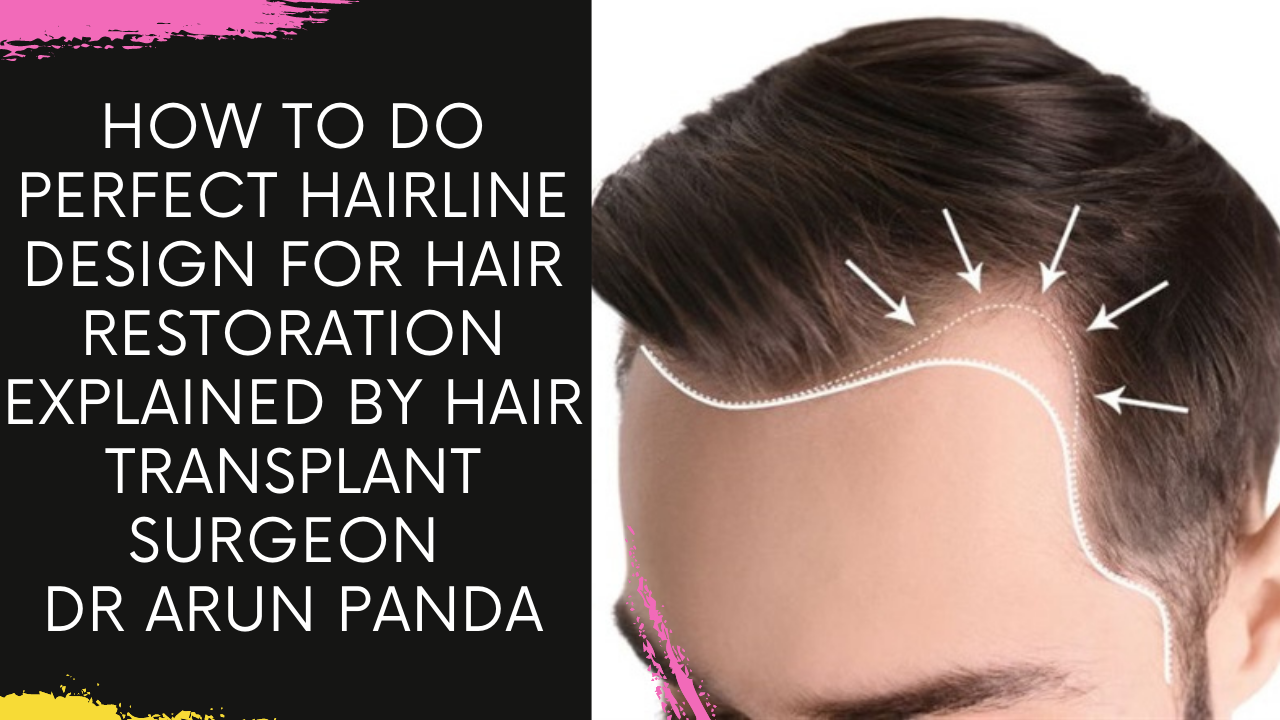 How to do perfect hairline design for hair restoration explained by Hair