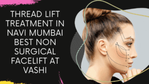 Read more about the article Thread Lift Treatment in Navi Mumbai | Best Non Surgical Facelift at Vashi