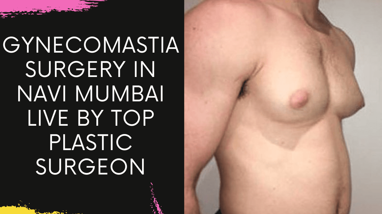 Gynecomastia Surgery in Navi Mumbai live by Top Plastic Surgeon