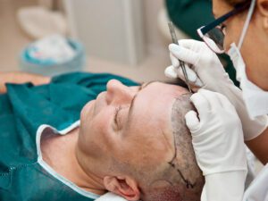 Read more about the article Best Hair Transplant and Cosmetology training in India