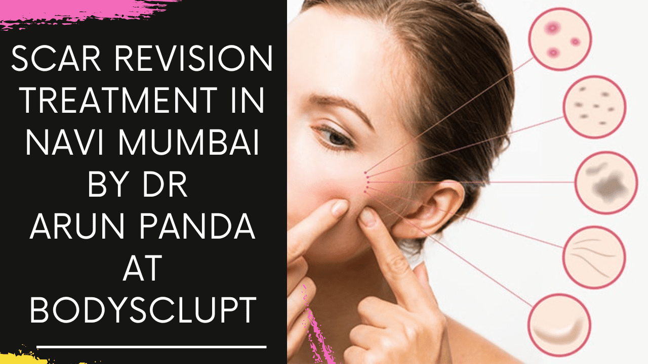 Scar Revision Treatment in Navi Mumbai by Dr Arun Panda at Bodysclupt