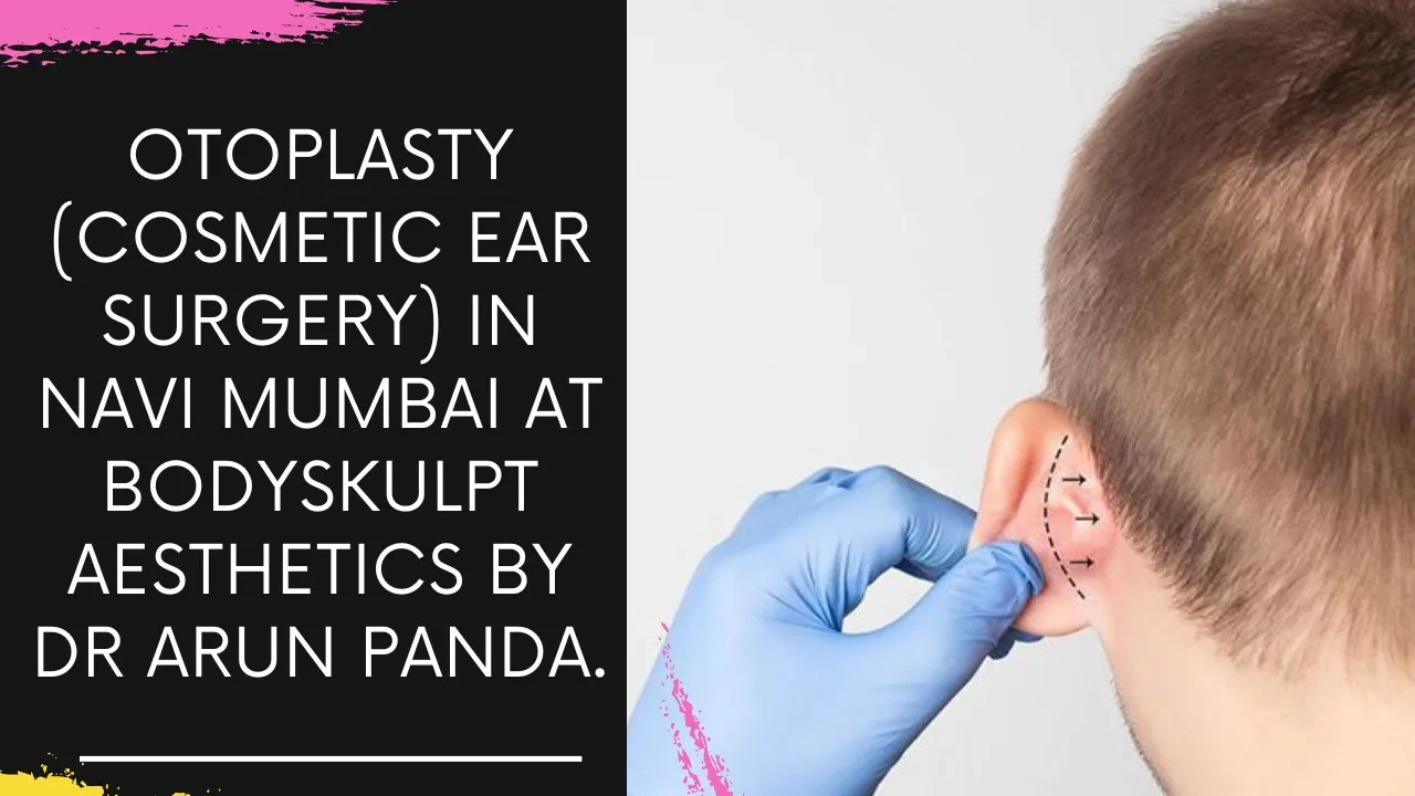 You are currently viewing Otoplasty (Cosmetic Ear Surgery) in Navi Mumbai at Bodyskulpt Aesthetics by Dr Arun Panda.