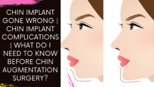 Read more about the article Chin Implant Gone Wrong | Chin Implant Complications | What do I need to know of before surgery?