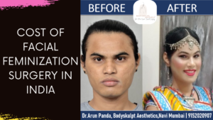 Read more about the article Cost of Facial Feminization Surgery in India | Price of Transgender Facial Surgery #ffs