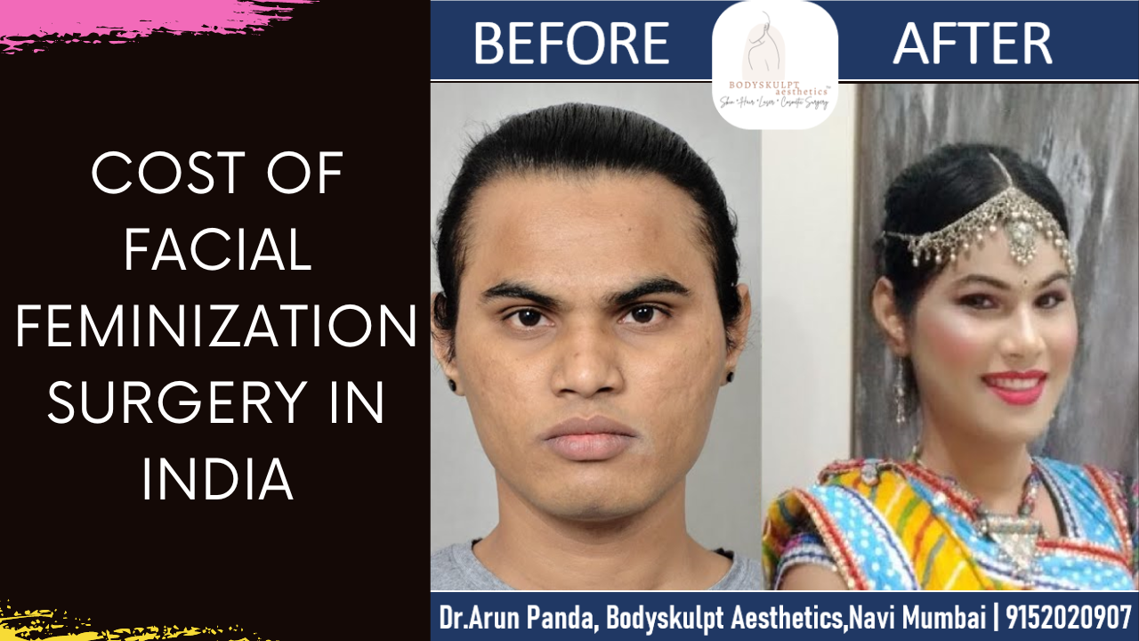 Cost of Facial Feminization Surgery in India