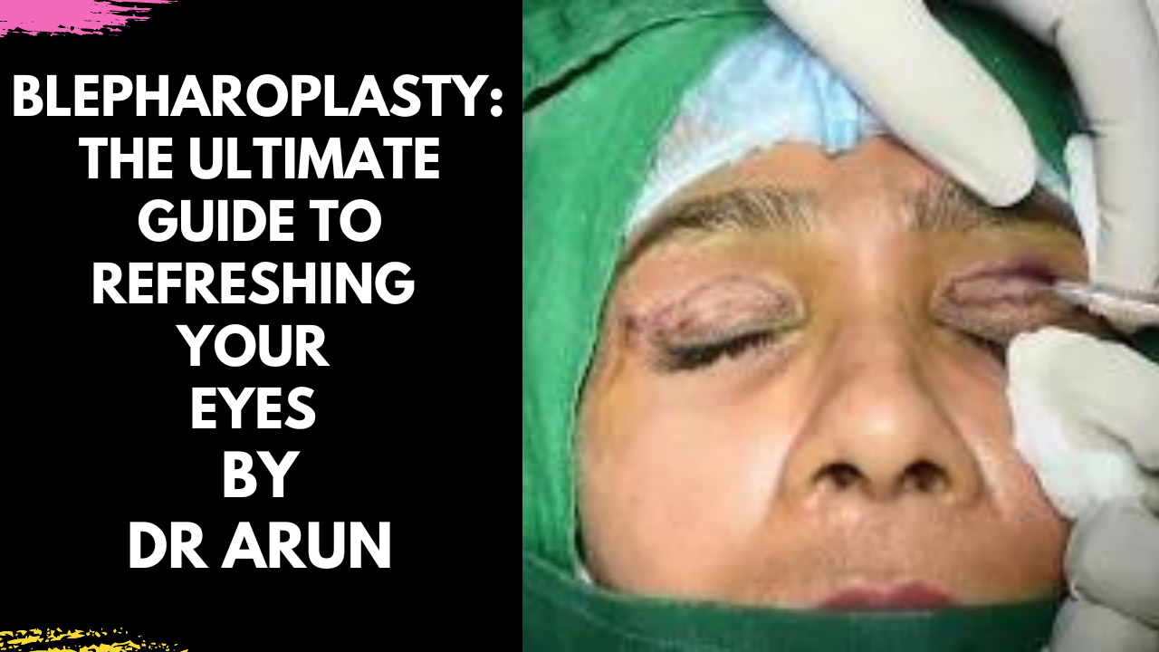 You are currently viewing Blepharoplasty: Refresh Your Eyes by Dr Arun Panda