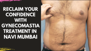 Read more about the article Reclaim Your Confidence with Gynecomastia Treatment in Navi Mumbai