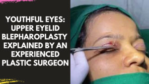 Read more about the article Upper Eyelid Blepharoplasty: Rejuvenate Your Eyes and Restore Youthfulness